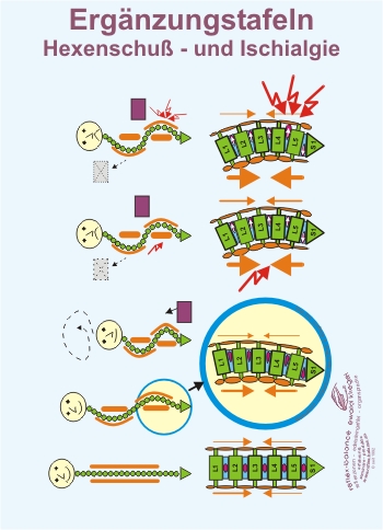 Reflexzonen Erg&auml;nzung - Hexenschuss und Ischialgie