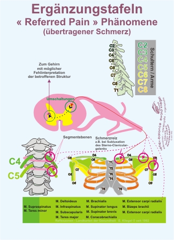Reflexzonen Erg&auml;nzung - &laquo; Referred Pain &raquo; Ph&auml;nomene (&uuml;bertragener Schmerz)